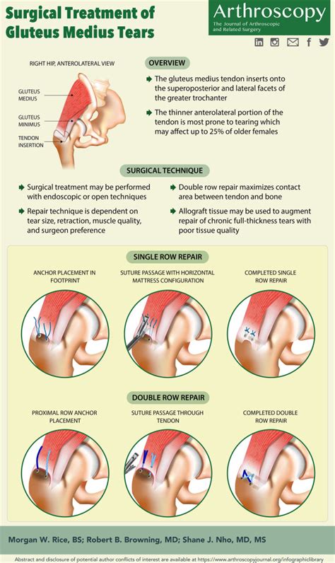 test for glut med tear|gluteus medius tear treatment.